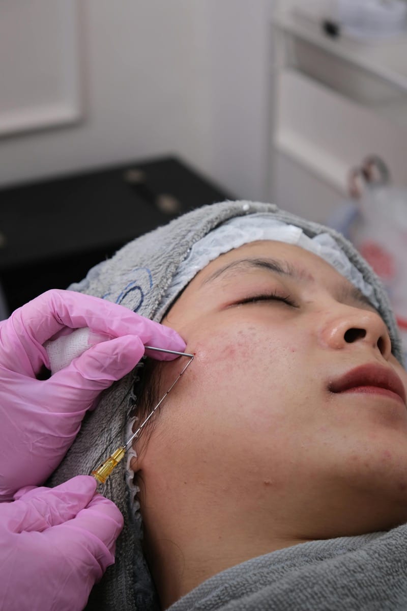 Biolifting