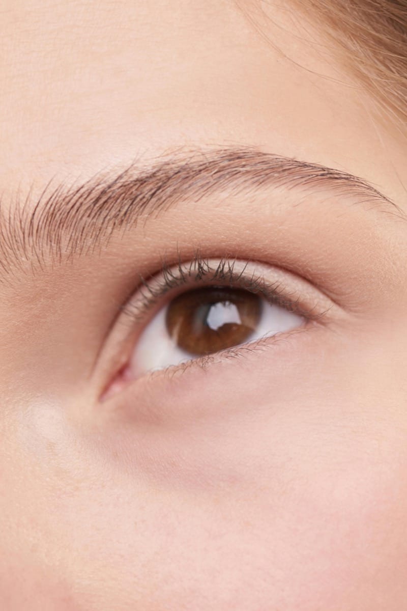Tratamiento de Ojeras